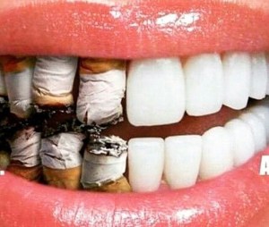 Smoking Dental Care