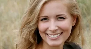 best veneers